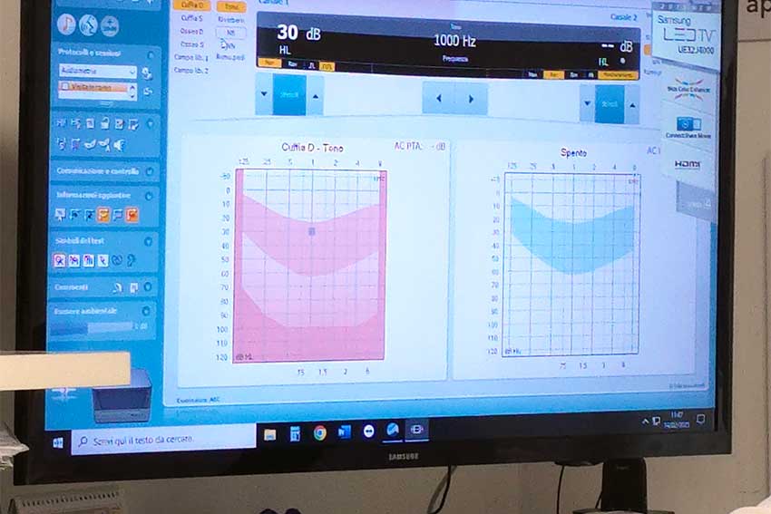 Dalla Diagnosi alla Riabilitazione Centro-Audioprotesico Taranto Otosalus percorsi